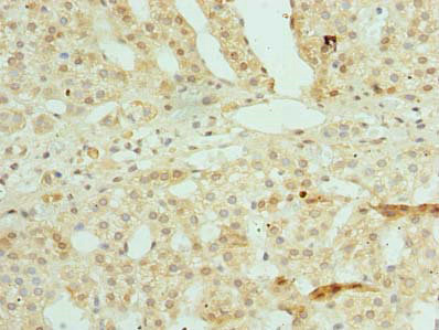Immunohistochemistry of paraffin-embedded human adrenal gland tissue using CSB-PA026569LA01HU at dilution of 1:100