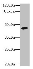 Western blot All lanes: ZSCAN9 antibody at 0.3microg/ml + Mouse brain tissue Secondary Goat polyclonal to rabbit IgG at 1/10000 dilution Predicted band size: 46, 52 kDa Observed band size: 46 kDa Western blot All lanes: ZSCAN9 antibody at 0.3microg/ml + Mouse brain tissue Secondary Goat polyclonal to rabbit IgG at 1/10000 dilution Predicted band size: 46, 52 kDa Observed band size: 46 kDa