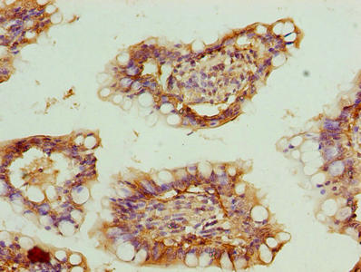 Immunohistochemistry of paraffin-embedded human small intestine tissue using CSB-PA026637LA01HU at dilution of 1:100