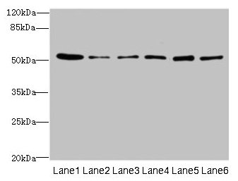 Western blot All lanes: ZNF398 antibody at 3microg/ml Lane 1: 293T whole cell lysate Lane 2: Hela whole cell lysate Lane 3: HepG2 whole cell lysate Lane 4: Jurkat whole cell lysate Lane 5: Caco-2 whole cell lysate Lane 6: A549 whole cell lysate Secondary Goat polyclonal to rabbit IgG at 1/10000 dilution Predicted band size: 72, 53 kDa Observed band size: 53 kDa Western blot All lanes: ZNF398 antibody at 3microg/ml Lane 1: 293T whole cell lysate Lane 2: Hela whole cell lysate Lane 3: HepG2 whole cell lysate Lane 4: Jurkat whole cell lysate Lane 5: Caco-2 whole cell lysate Lane 6: A549 whole cell lysate Secondary Goat polyclonal to rabbit IgG at 1/10000 dilution Predicted band size: 72, 53 kDa Observed band size: 53 kDa