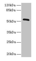 Western blot All lanes: ZNF410 antibody at 3microg/ml + Mouse brain tissue Secondary Goat polyclonal to rabbit IgG at 1/10000 dilution Predicted band size: 53, 30, 48, 45, 56 kDa Observed band size: 53 kDa Western blot All lanes: ZNF410 antibody at 3microg/ml + Mouse brain tissue Secondary Goat polyclonal to rabbit IgG at 1/10000 dilution Predicted band size: 53, 30, 48, 45, 56 kDa Observed band size: 53 kDa