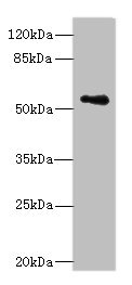 Western blot All lanes: ZSCAN32 antibody at 1microg/ml + MCF-7 whole cell lysate Secondary Goat polyclonal to rabbit IgG at 1/10000 dilution Predicted band size: 79, 55, 47 kDa Observed band size: 55 kDa Western blot All lanes: ZSCAN32 antibody at 1microg/ml + MCF-7 whole cell lysate Secondary Goat polyclonal to rabbit IgG at 1/10000 dilution Predicted band size: 79, 55, 47 kDa Observed band size: 55 kDa