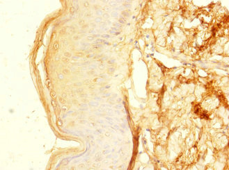 Immunohistochemistry of paraffin-embedded human skin tissue using CSB-PA026804LA01HU at dilution of 1:100 Immunohistochemistry of paraffin-embedded human skin tissue using CSB-PA026804LA01HU at dilution of 1:100