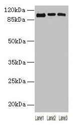 Western blot All lanes: ZNF546 antibody at 4microg/ml Lane 1: A549 whole cell lysate Lane 2: 293T whole cell lysate Lane 3: Hela whole cell lysate Secondary Goat polyclonal to rabbit IgG at 1/10000 dilution Predicted band size: 99 kDa Observed band size: 99 kDa Western blot All lanes: ZNF546 antibody at 4microg/ml Lane 1: A549 whole cell lysate Lane 2: 293T whole cell lysate Lane 3: Hela whole cell lysate Secondary Goat polyclonal to rabbit IgG at 1/10000 dilution Predicted band size: 99 kDa Observed band size: 99 kDa