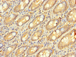 Immunohistochemistry of paraffin-embedded human small intestine tissue using CSB-PA026843LA01HU at dilution of 1:100