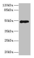 Western blot All lanes: ZNF562 antibody at 12microg/ml + 293T whole cell lysate Secondary Goat polyclonal to rabbit IgG at 1/10000 dilution Predicted band size: 49, 41 kDa Observed band size: 49 kDa Western blot All lanes: ZNF562 antibody at 12microg/ml + 293T whole cell lysate Secondary Goat polyclonal to rabbit IgG at 1/10000 dilution Predicted band size: 49, 41 kDa Observed band size: 49 kDa