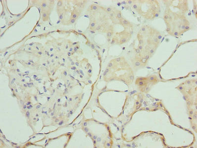 Immunohistochemistry of paraffin-embedded human kidney tissue using CSB-PA026844LA01HU at dilution of 1:100