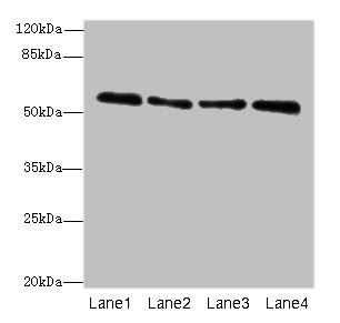 Western blot All lanes: ZNF563 antibody at 7microg/ml Lane 1: Hela whole cell lysate Lane 2: A549 whole cell lysate Lane 3: MCF-7 whole cell lysate Lane 4: K562 whole cell lysate Secondary Goat polyclonal to rabbit IgG at 1/10000 dilution Predicted band size: 56, 27 kDa Observed band size: 56 kDa Western blot All lanes: ZNF563 antibody at 7microg/ml Lane 1: Hela whole cell lysate Lane 2: A549 whole cell lysate Lane 3: MCF-7 whole cell lysate Lane 4: K562 whole cell lysate Secondary Goat polyclonal to rabbit IgG at 1/10000 dilution Predicted band size: 56, 27 kDa Observed band size: 56 kDa