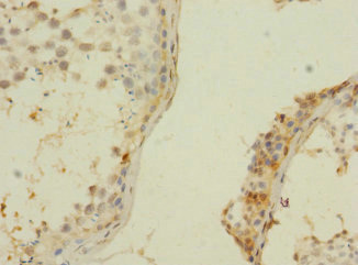 Immunohistochemistry of paraffin-embedded human testis tissue using CSB-PA026845LA01HU at dilution of 1:100 Immunohistochemistry of paraffin-embedded human testis tissue using CSB-PA026845LA01HU at dilution of 1:100