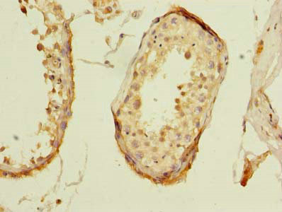 Immunohistochemistry of paraffin-embedded human testis tissue using CSB-PA026893LA01HU at dilution of 1:100