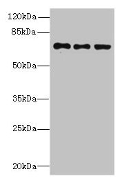 Western blot All lanes: ZNF614 antibody at 6microg/ml Lane 1: Jurkat whole cell lysate Lane 2: HepG2 whole cell lysate Lane 3: A549 whole cell lysate Secondary Goat polyclonal to rabbit IgG at 1/10000 dilution Predicted band size: 68, 23 kDa Observed band size: 68 kDa Western blot All lanes: ZNF614 antibody at 6microg/ml Lane 1: Jurkat whole cell lysate Lane 2: HepG2 whole cell lysate Lane 3: A549 whole cell lysate Secondary Goat polyclonal to rabbit IgG at 1/10000 dilution Predicted band size: 68, 23 kDa Observed band size: 68 kDa