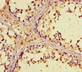 Immunohistochemistry of paraffin-embedded human testis tissue using CSB-PA026928LA01HU at dilution of 1:100 Immunohistochemistry of paraffin-embedded human testis tissue using CSB-PA026928LA01HU at dilution of 1:100