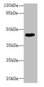 Western blot All lanes: ZNF670 antibody at 5microg/ml + HepG2 whole cell lysate Secondary Goat polyclonal to rabbit IgG at 1/10000 dilution Predicted band size: 45 kDa Observed band size: 45 kDa Western blot All lanes: ZNF670 antibody at 5microg/ml + HepG2 whole cell lysate Secondary Goat polyclonal to rabbit IgG at 1/10000 dilution Predicted band size: 45 kDa Observed band size: 45 kDa