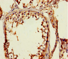 Immunohistochemistry of paraffin-embedded human testis tissue using CSB-PA027025LA01HU at dilution of 1:100 Immunohistochemistry of paraffin-embedded human testis tissue using CSB-PA027025LA01HU at dilution of 1:100