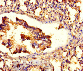 Immunohistochemistry of paraffin-embedded human lung tissue using CSB-PA027025LA01HU at dilution of 1:100