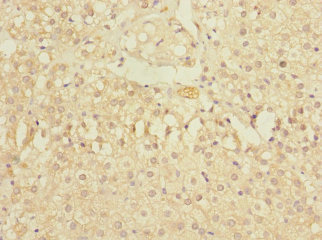 Immunohistochemistry of paraffin-embedded human adrenal gland tissue using CSB-PA027047LA01HU at dilution of 1:100