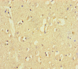 Immunohistochemistry of paraffin-embedded human brain tissue using CSB-PA027053LA01HU at dilution of 1:100 Immunohistochemistry of paraffin-embedded human brain tissue using CSB-PA027053LA01HU at dilution of 1:100