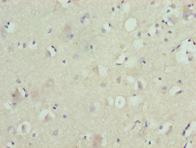 Immunohistochemistry of paraffin-embedded human brain tissue using CSB-PA027066LA01HU at dilution of 1:100
