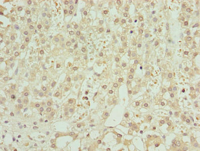 Immunohistochemistry of paraffin-embedded human adrenal gland tissue using CSB-PA027066LA01HU at dilution of 1:100
