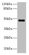 Western blot All lanes: ZNF821 antibody at 8microg/ml + MCF-7 whole cell lysate Secondary Goat polyclonal to rabbit IgG at 1/10000 dilution Predicted band size: 47, 43 kDa Observed band size: 47 kDa Western blot All lanes: ZNF821 antibody at 8microg/ml + MCF-7 whole cell lysate Secondary Goat polyclonal to rabbit IgG at 1/10000 dilution Predicted band size: 47, 43 kDa Observed band size: 47 kDa