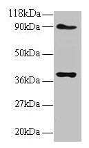 Western blot All lanes: NDUFS5 antibody at 2microg/ml Lane 1: EC109 whole cell lysate Lane 2: 293T whole cell lysate Secondary Goat polyclonal to rabbit IgG at 1/15000 dilution Predicted band size: 13 kDa Observed band size: 40 kDa Western blot All lanes: NDUFS5 antibody at 2microg/ml Lane 1: EC109 whole cell lysate Lane 2: 293T whole cell lysate Secondary Goat polyclonal to rabbit IgG at 1/15000 dilution Predicted band size: 13 kDa Observed band size: 40 kDa