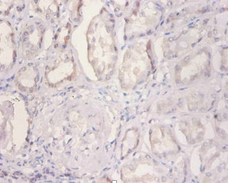Immunohistochemistry of paraffin-embedded human kidney tissue using CSB-PA02989A0Rb at dilution of 1:100 Immunohistochemistry of paraffin-embedded human kidney tissue using CSB-PA02989A0Rb at dilution of 1:100
