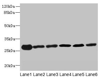 Western blot All lanes: TMED9 antibody at 4.5microg/ml Lane 1: Mouse liver tissue Lane 2: Mouse kidney tissue Lane 3: Human placenta tissue Lane 4: A549 whole cell lysate Lane 5: MCF-7 whole cell lysate Lane 6: A431 whole cell lysate Secondary Goat polyclonal to rabbit IgG at 1/10000 dilution Predicted band size: 28 kDa Observed band size: 28 kDa