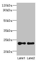 Western blot All lanes: TMED2 antibody at 6microg/ml Lane 1: HCT116 whole cell lysate Lane 2: Mouse ovarian tissue Secondary Goat polyclonal to rabbit IgG at 1/10000 dilution Predicted band size: 23 kDa Observed band size: 23 kDa