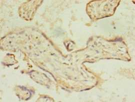 CSB-PA060488EA01HU