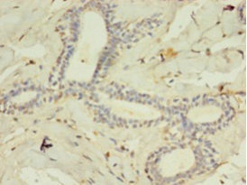 CSB-PA060488EA01HU