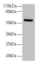 Western Blotting(WB) - MMP1 Antibody