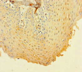 Immunohistochemistry of paraffin-embedded human tonsil tissue using CSB-PA07085A0Rb at dilution of 1:100