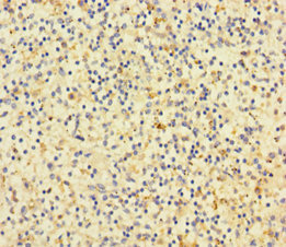 Immunohistochemistry of paraffin-embedded human spleen tissue using CSB-PA07085A0Rb at dilution of 1:100