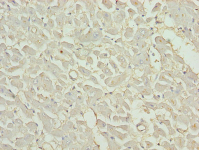 Immunohistochemistry of paraffin-embedded human heart tissue using CSB-PA07917A0Rb at dilution of 1:100