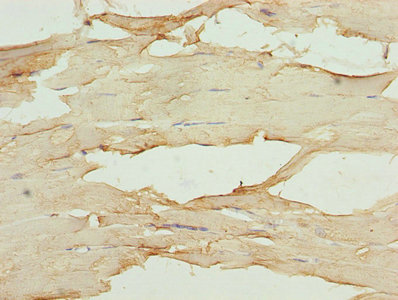 Immunohistochemistry of paraffin-embedded human skeletal muscle tissue using CSB-PA07917A0Rb at dilution of 1:100