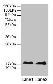 Western blot All lanes: MB antibody at 2microg/ml Lane 1: Rat skeletal muscle tissue Lane 2: Mouse heart tissue Secondary Goat polyclonal to rabbit IgG at 1/10000 dilution Predicted band size: 18 kDa Observed band size: 18 kDa Western blot All lanes: MB antibody at 2microg/ml Lane 1: Rat skeletal muscle tissue Lane 2: Mouse heart tissue Secondary Goat polyclonal to rabbit IgG at 1/10000 dilution Predicted band size: 18 kDa Observed band size: 18 kDa