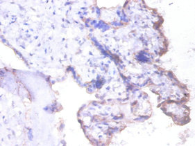 Immunohistochemistry of paraffin-embedded human placenta tissue using CSB-PA11759A0Rb at dilution of 1:100