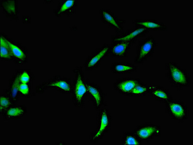 Immunofluorescent analysis of Hela cells using CSB-PA11829A0Rb at dilution of 1:100 and Alexa Fluor 488-congugated AffiniPure Goat Anti-Rabbit IgG(H+L)