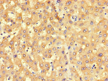 Immunohistochemistry of paraffin-embedded human liver tissue using CSB-PA11829A0Rb at dilution of 1:100