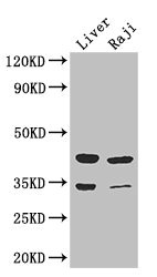 Western Blot Positive WB detected in: Mouse liver tissue, Raji whole cell lysate All lanes: BHMT2 antibody at 3microg/ml Secondary Goat polyclonal to rabbit IgG at 1/50000 dilution Predicted band size: 41, 34 kDa Observed band size: 41, 34 kDa