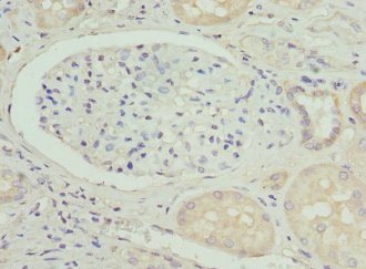Immunohistochemistry of paraffin-embedded human kidney tissue using CSB-PA11834A0Rb at dilution of 1:100