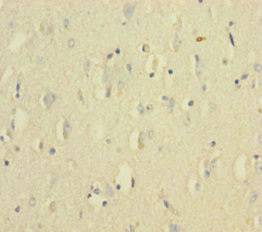 Immunohistochemistry of paraffin-embedded human brain tissue using CSB-PA12779A0Rb at dilution of 1:100