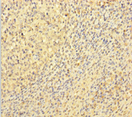 Immunohistochemistry of paraffin-embedded human tonsil tissue using CSB-PA12779A0Rb at dilution of 1:100