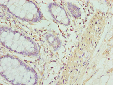 Immunohistochemistry of paraffin-embedded human colon tissue using CSB-PA12799A0Rb at dilution of 1:100