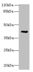 Western blot All lanes: ACTG2 antibody at 3microg/ml + CEM whole cell lysate Secondary Goat polyclonal to rabbit IgG at 1/10000 dilution Predicted band size: 42, 38 kDa Observed band size: 42 kDa