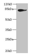 Western blot All lanes: JUP antibody at 2microg/ml + A431 whole cell lysate Secondary Goat polyclonal to rabbit IgG at 1/10000 dilution Predicted band size: 82 kDa Observed band size: 82 kDa