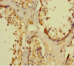 Immunohistochemistry of paraffin-embedded human testis tissue using CSB-PA13019A0Rb at dilution of 1:100