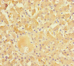 Immunohistochemistry of paraffin-embedded human liver tissue using CSB-PA13019A0Rb at dilution of 1:100
