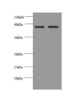 Western blot All lanes: CDH12 antibody at 2microg/ml Lane 1: EC109 whole cell lysate Lane 2: 293T whole cell lysate Secondary Goat polyclonal to rabbit IgG at 1/10000 dilution Predicted band size: 89, 85 kDa Observed band size: 85 kDa Western blot All lanes: CDH12 antibody at 2microg/ml Lane 1: EC109 whole cell lysate Lane 2: 293T whole cell lysate Secondary Goat polyclonal to rabbit IgG at 1/10000 dilution Predicted band size: 89, 85 kDa Observed band size: 85 kDa