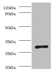Western blot All lanes: ureA antibody at 2microg/ml + Helicobacter pylori bacteria liquid Secondary Goat polyclonal to rabbit IgG at 1/10000 dilution Predicted band size: 27 kDa Observed band size: 27 kDa Western blot All lanes: ureA antibody at 2microg/ml + Helicobacter pylori bacteria liquid Secondary Goat polyclonal to rabbit IgG at 1/10000 dilution Predicted band size: 27 kDa Observed band size: 27 kDa